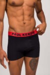 Boxer Paul Kenzie Marbling (2)